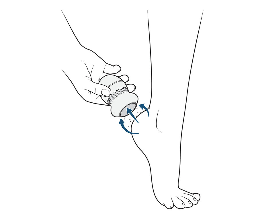 Hand verwendet Hornhautentferner mit Saugfunktion am Fuß.