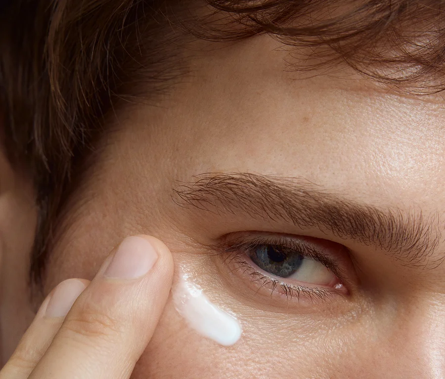 Nahaufnahme eines Gesichts, ein Finger trägt weiße Creme auf die Haut nahe dem äußeren Augenwinkel eines blauen Auges auf.