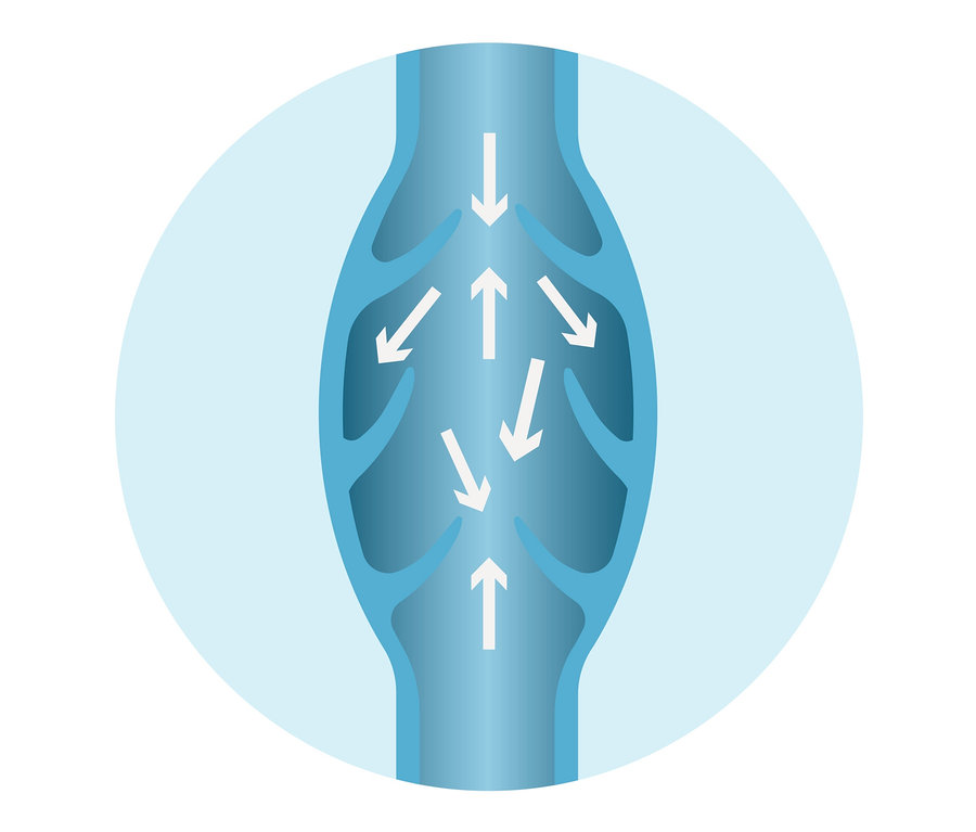 Illustration einer Vene mit weißen Pfeilen, die den Blutfluss darstellen. Therapiegerät "VenenWalker Pro2"